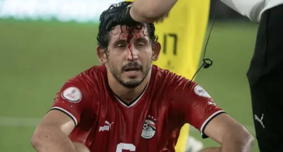 CAF-CAN 2023/1È JOURNÉE : LES DOUZE MATCHS…